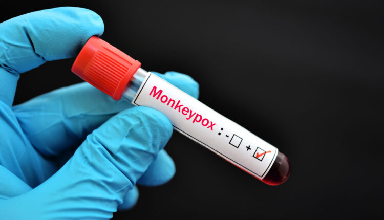 Federal officials declare a public health emergency for monkeypox ⋆ Michigan Advance