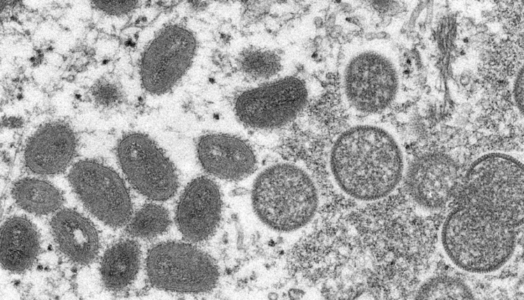 Detroit’s queer advocates worry about monkeypox – and messaging