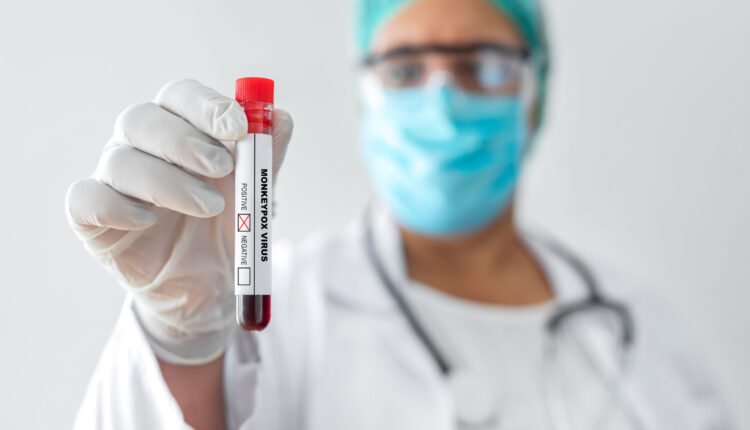 White House calls meeting with college officials on how to curb monkeypox on campus ⋆ Michigan Advance