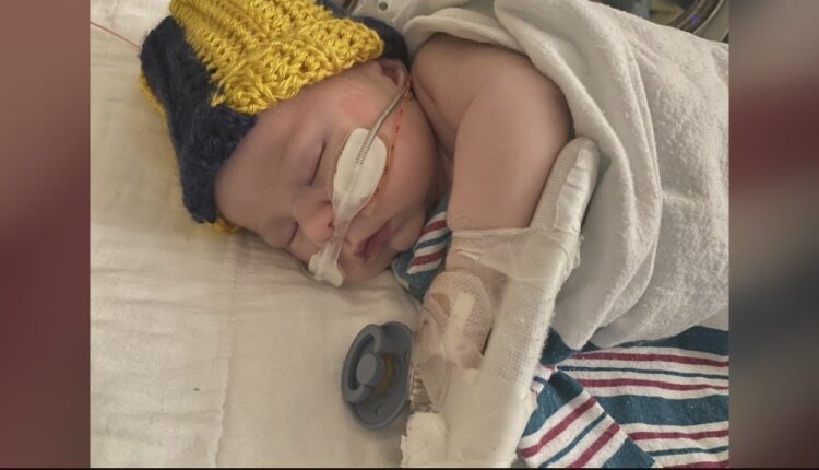 Metro Detroit hospitals see decrease in pediatric RSV cases after spike