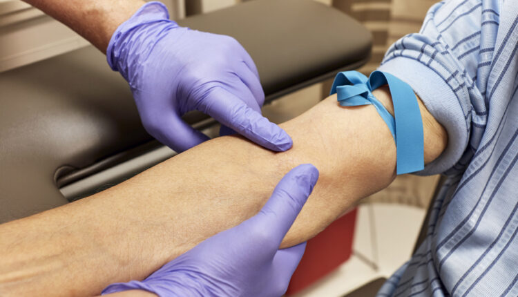 A health care technician preps the arm of a senior adult for a blood draw.